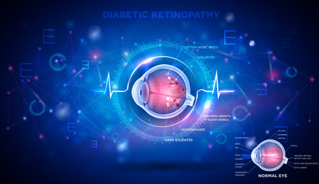 diabetes symptoms