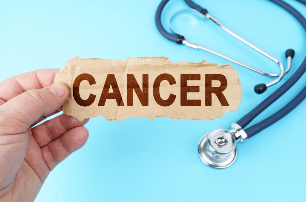 Καρκίνος της ουροδόχου κύστης: Τί να κάνετε για να μειώσετε τον κίνδυνο
