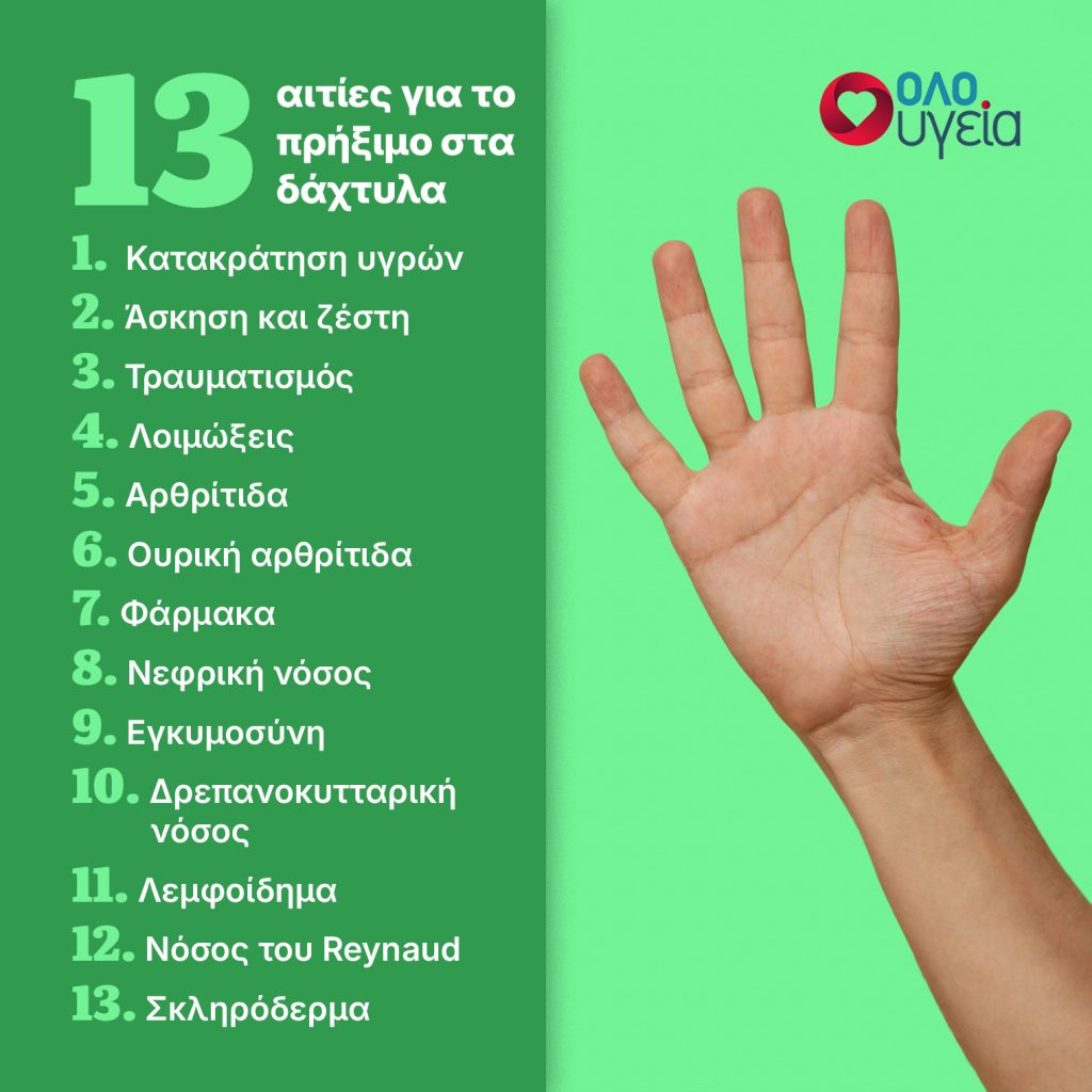 13 λόγοι για τους οποίους πρήζονται τα δάχτυλα σας - Πότε να ανησυχήσετε