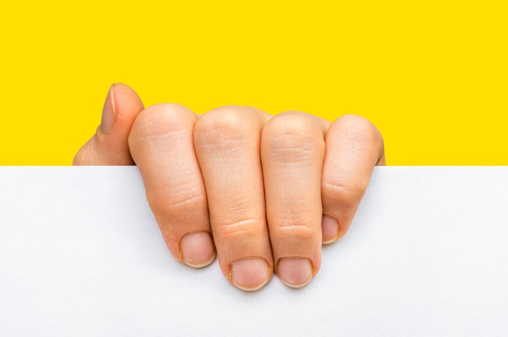 13 λόγοι για τους οποίους πρήζονται τα δάχτυλα σας-Πότε να ανησυχήσετε