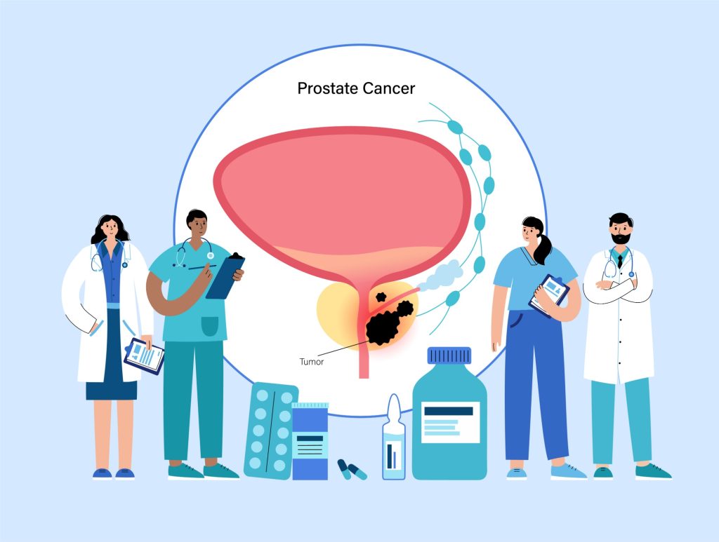 Καρκίνος του Προστάτη: Σημαντικές εξελίξεις στη διάγνωση και τη θεραπεία