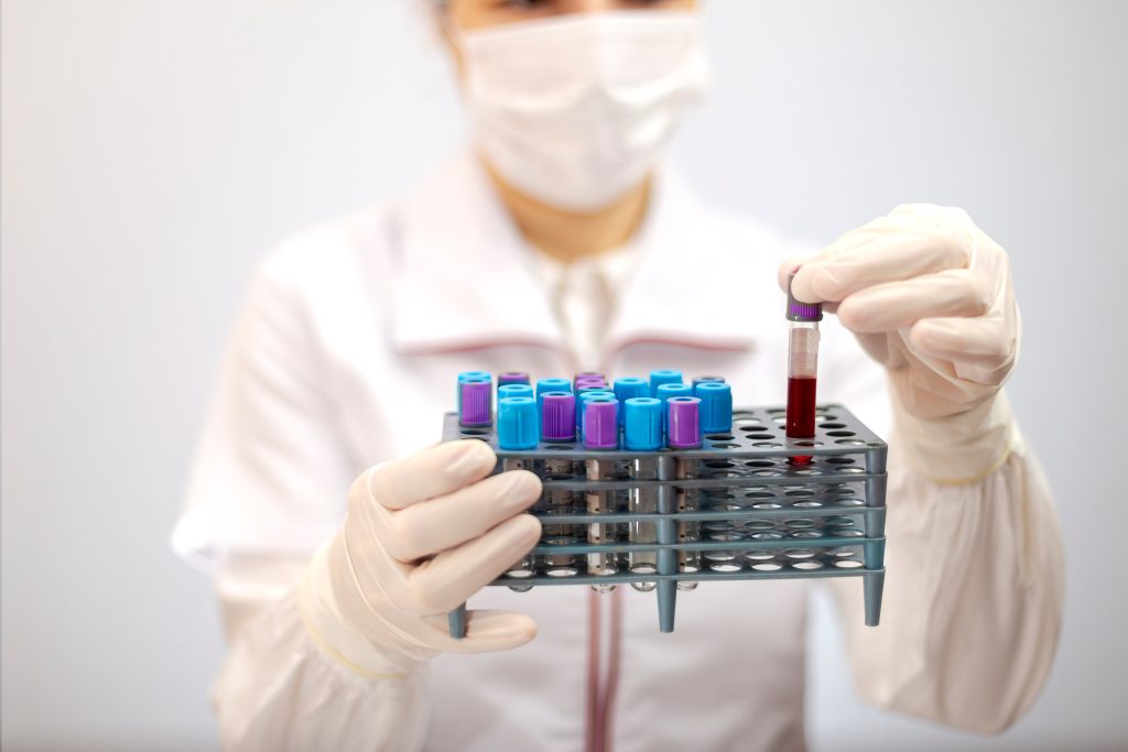 Άνοια: Τεστ αίματος μπορεί να την προβλέψει 10 χρόνια πριν διαγνωστεί σύμφωνα με νέα έρευνα