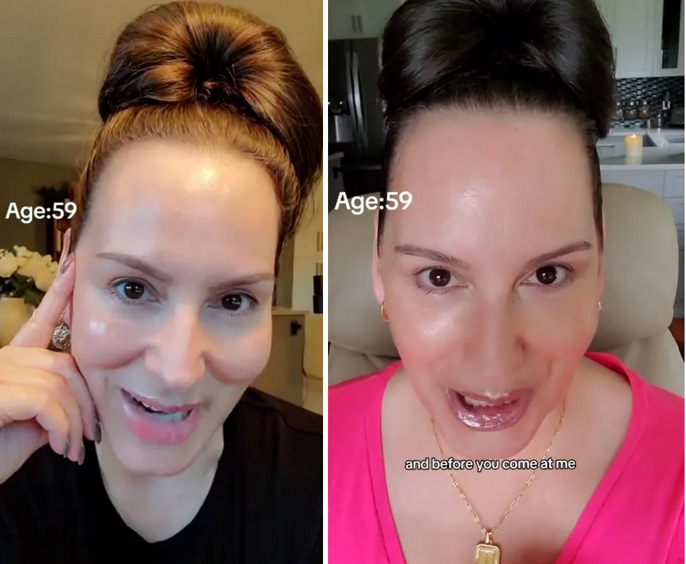 Μια 60χρονη που μοιάζει 30 ετών μοιράζεται τα μυστικά της για νεανικό δέρμα χωρίς botox