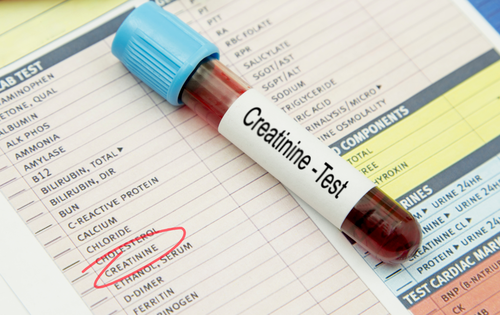 Υψηλή κρεατινίνη: Τα συμπτώματα που δεν πρέπει να αγνοήσετε