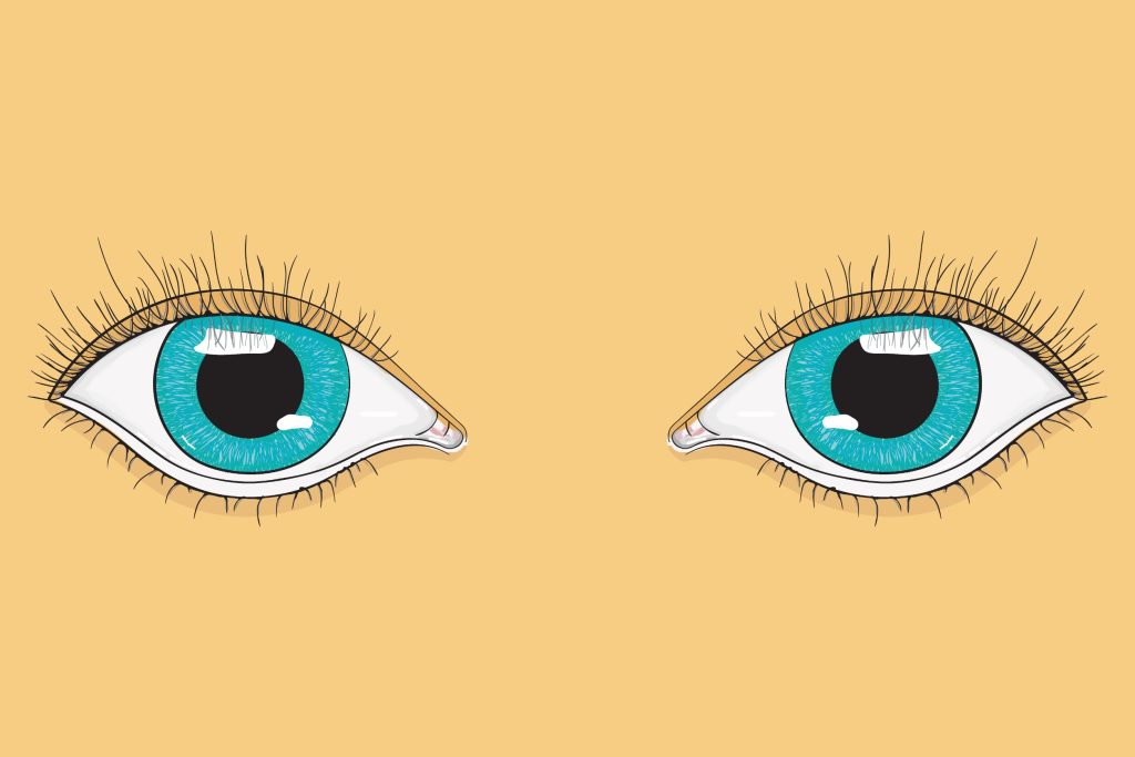 Ανοιγοκλείνετε συχνά τα μάτια σας; Μπορεί να είναι σύμπτωμα 7 ασθενειών