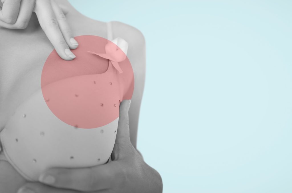 Καρκίνος του μαστού: Η παγοθεραπεία σκοτώνει τους όγκους – Επαναστατική μελέτη