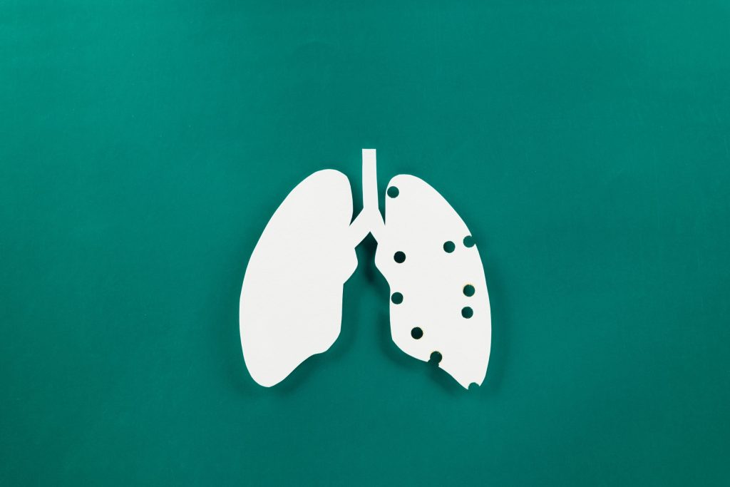 Καρκίνος του πνεύμονα: Τα 12 συμπτώματα που εμφανίζονται σε άτομα που δεν έχουν καπνίσει ποτέ
