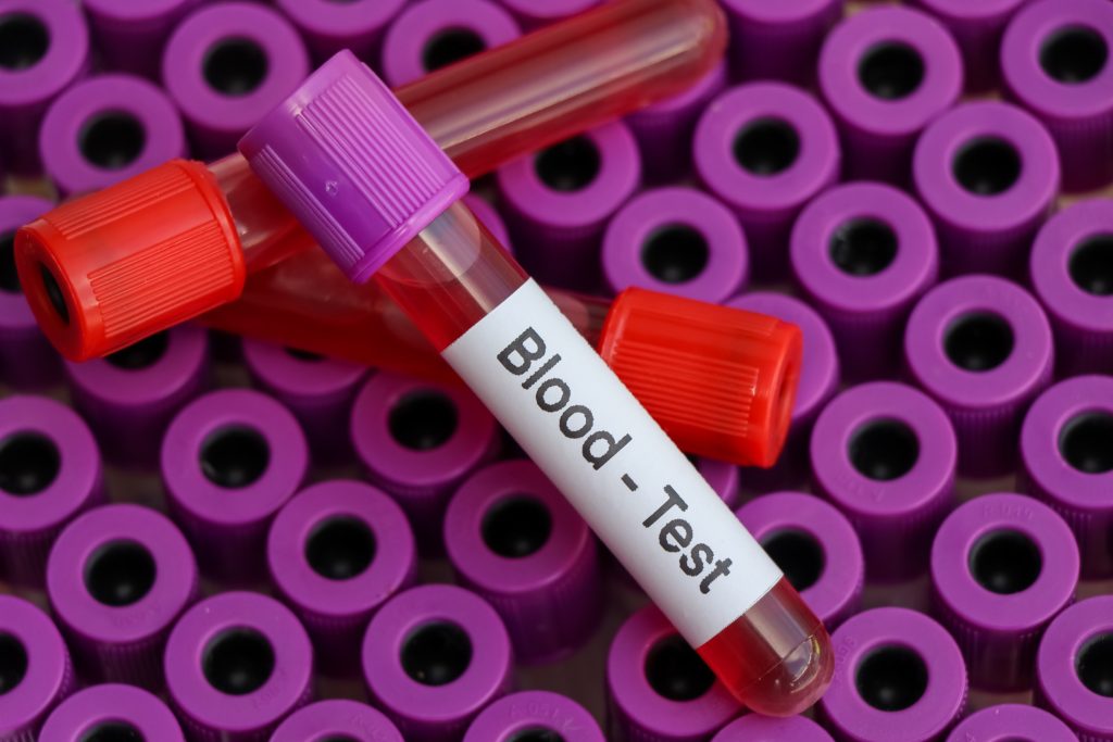 Καρκίνος: Εξέταση αίματος ανιχνεύει 19 διαφορετικούς τύπους έως και 7 χρόνια πριν την εμφάνιση των συμπτωμάτων
