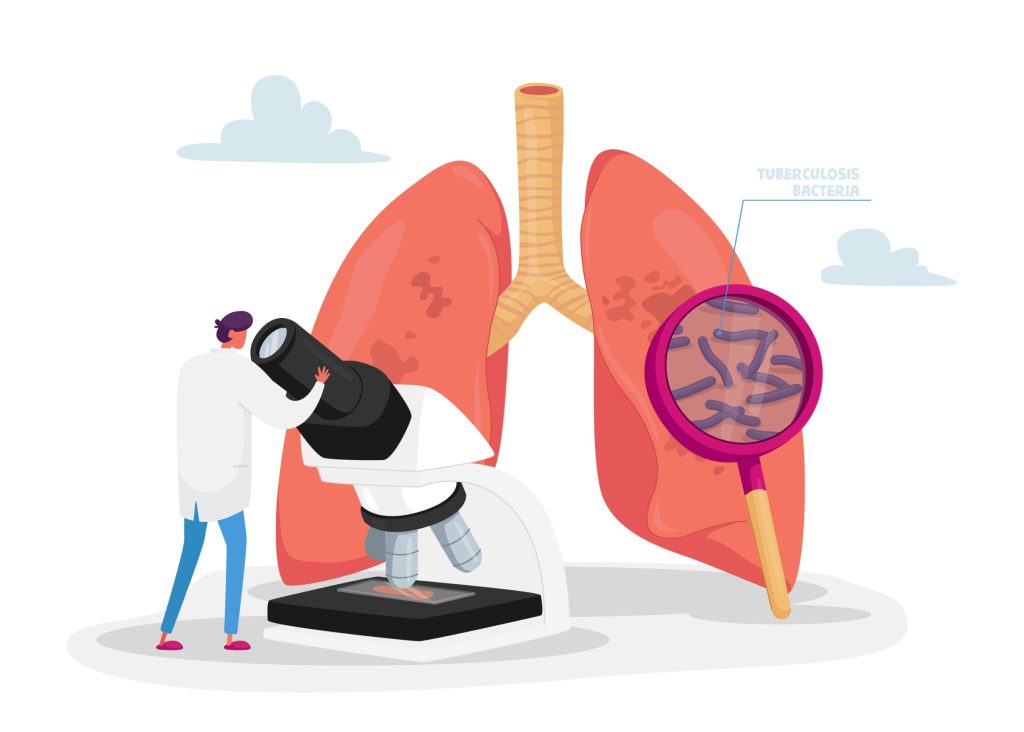 Καρκίνος του πνεύμονα: Ποια είναι τα συμπτώματα της νόσου και πώς αντιμετωπίζεται