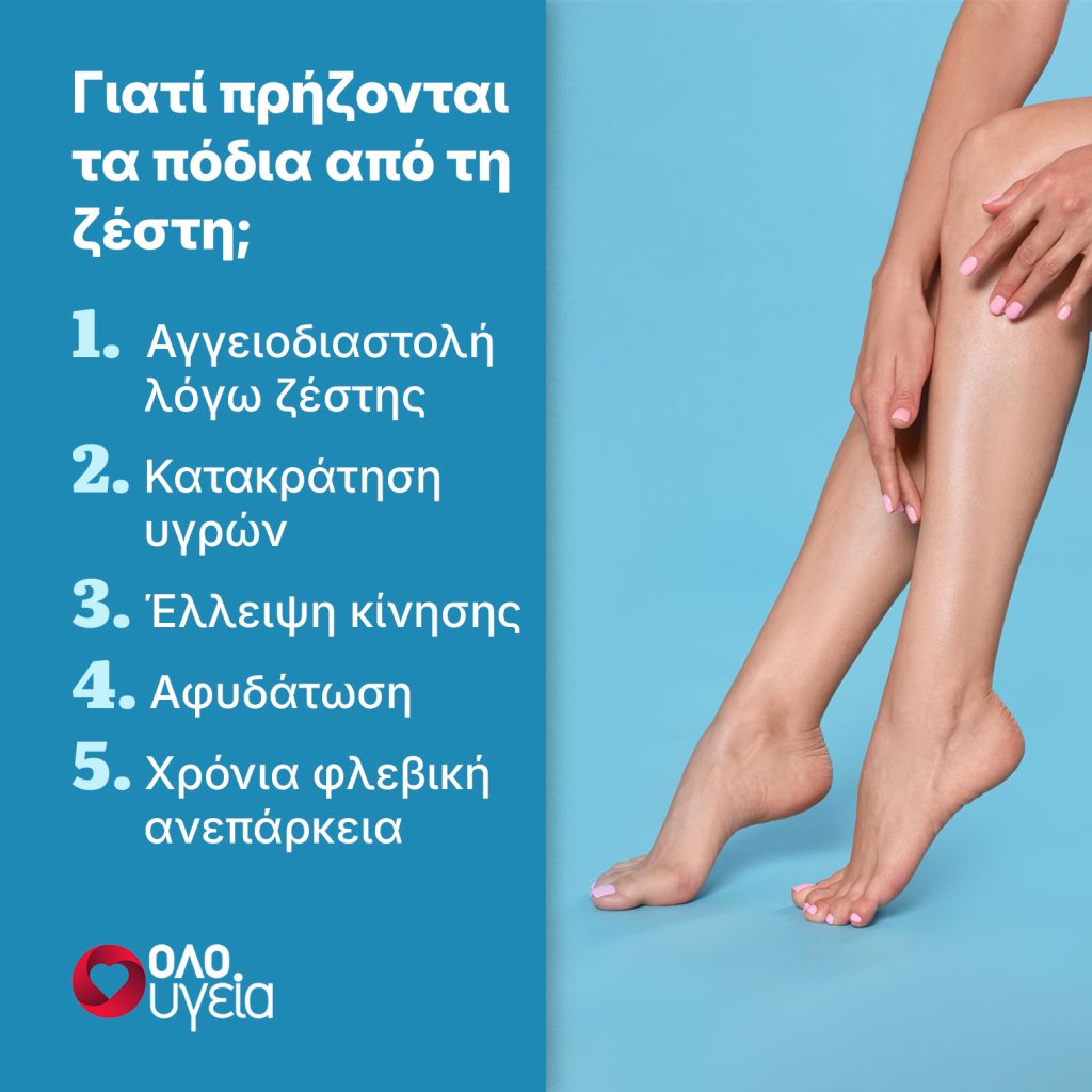 Πρησμένα πόδια από τη ζέστη: Πότε το οίδημα κρύβει κινδύνους για την υγεία σας