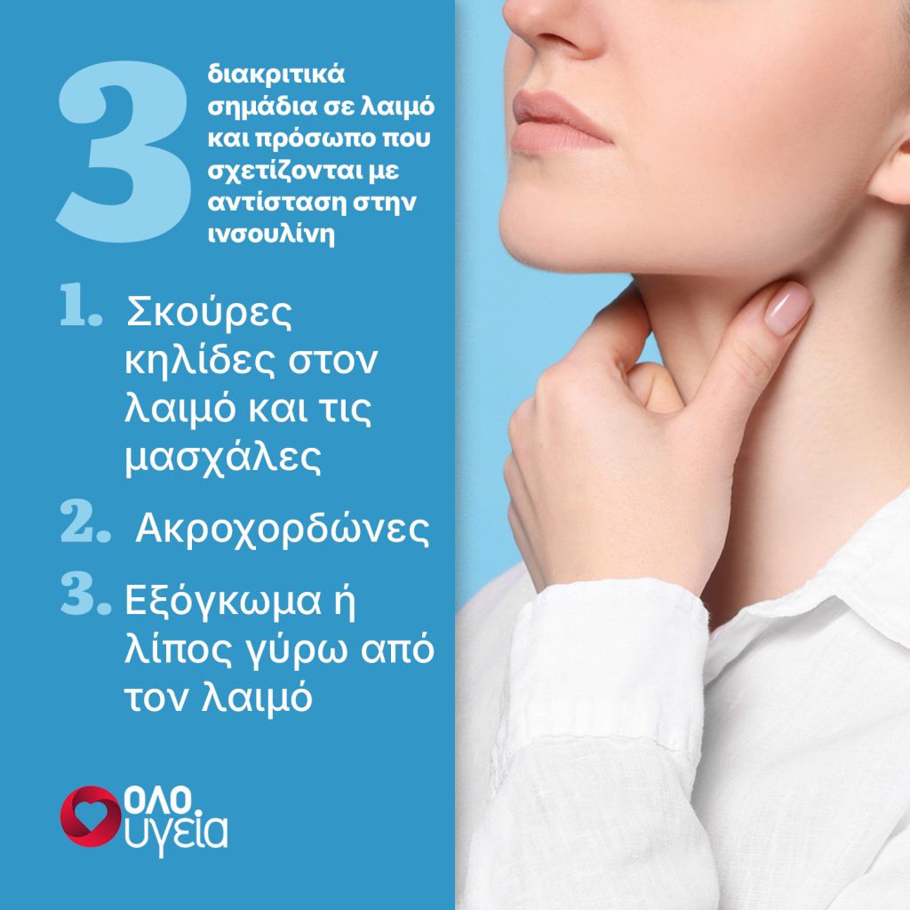3 σημάδια στο δέρμα που δείχνουν ότι μπορεί να έχετε αντίσταση στην ινσουλίνη