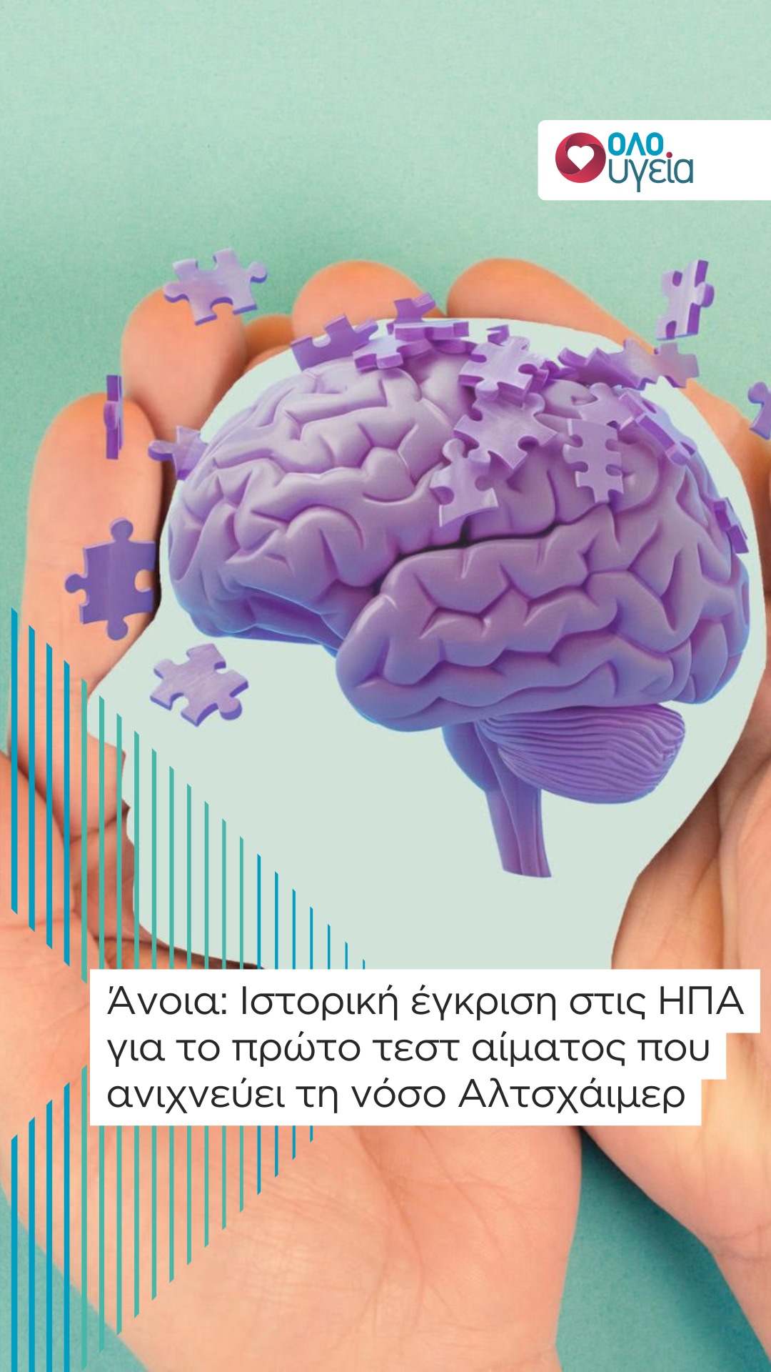 Άνοια: Ιστορική έγκριση στις ΗΠΑ για το πρώτο τεστ αίματος που ανιχνεύει τη νόσο Αλτσχάιμερ