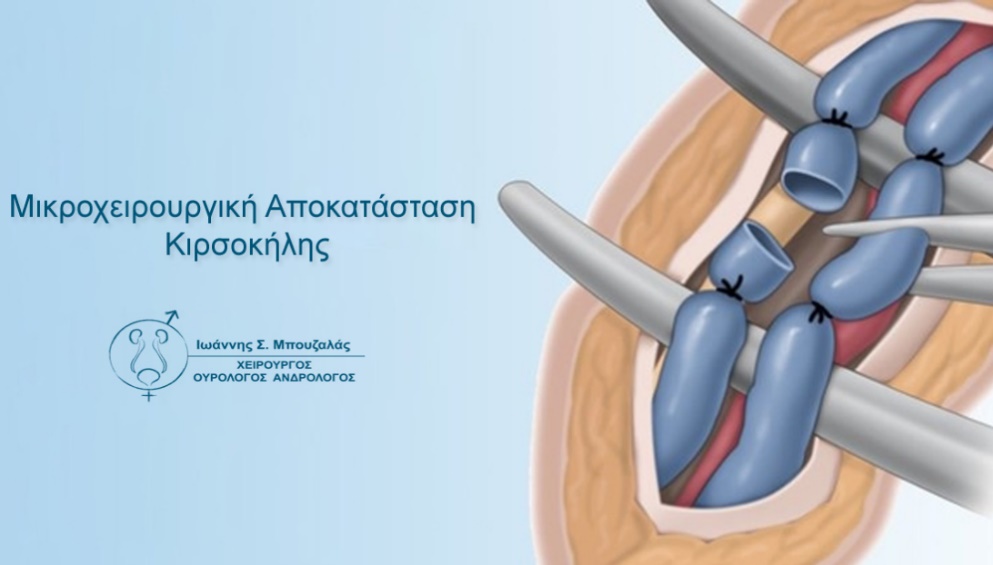 Κιρσοκήλη: Η ύπουλη αιτία ανδρικής υπογονιμότητας και η σύγχρονη χειρουργική αντιμετώπιση