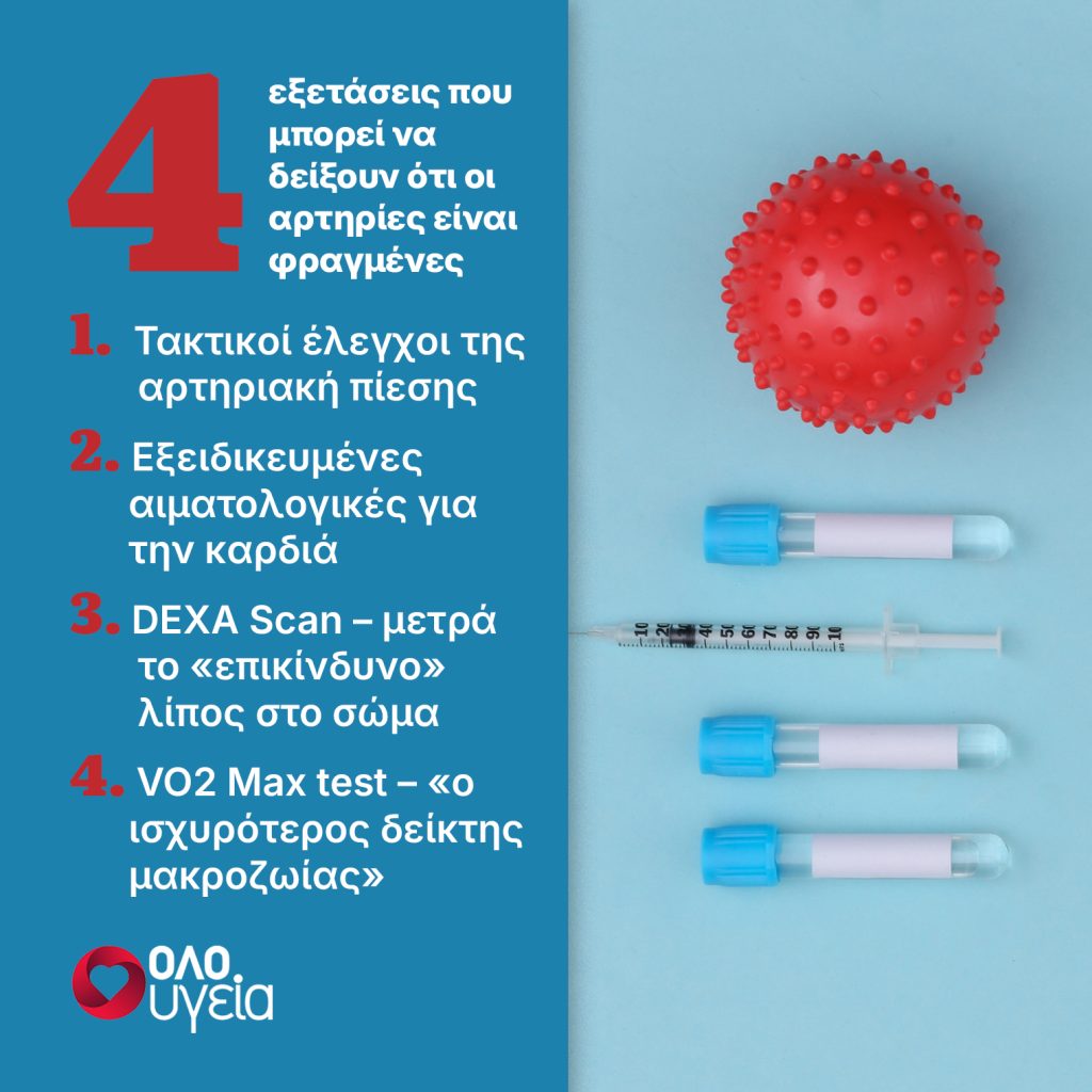 «Είμαι καρδιολόγος – Αυτές είναι οι 4 εξετάσεις που δείχνουν αν έχετε φραγμένες αρτηρίες»