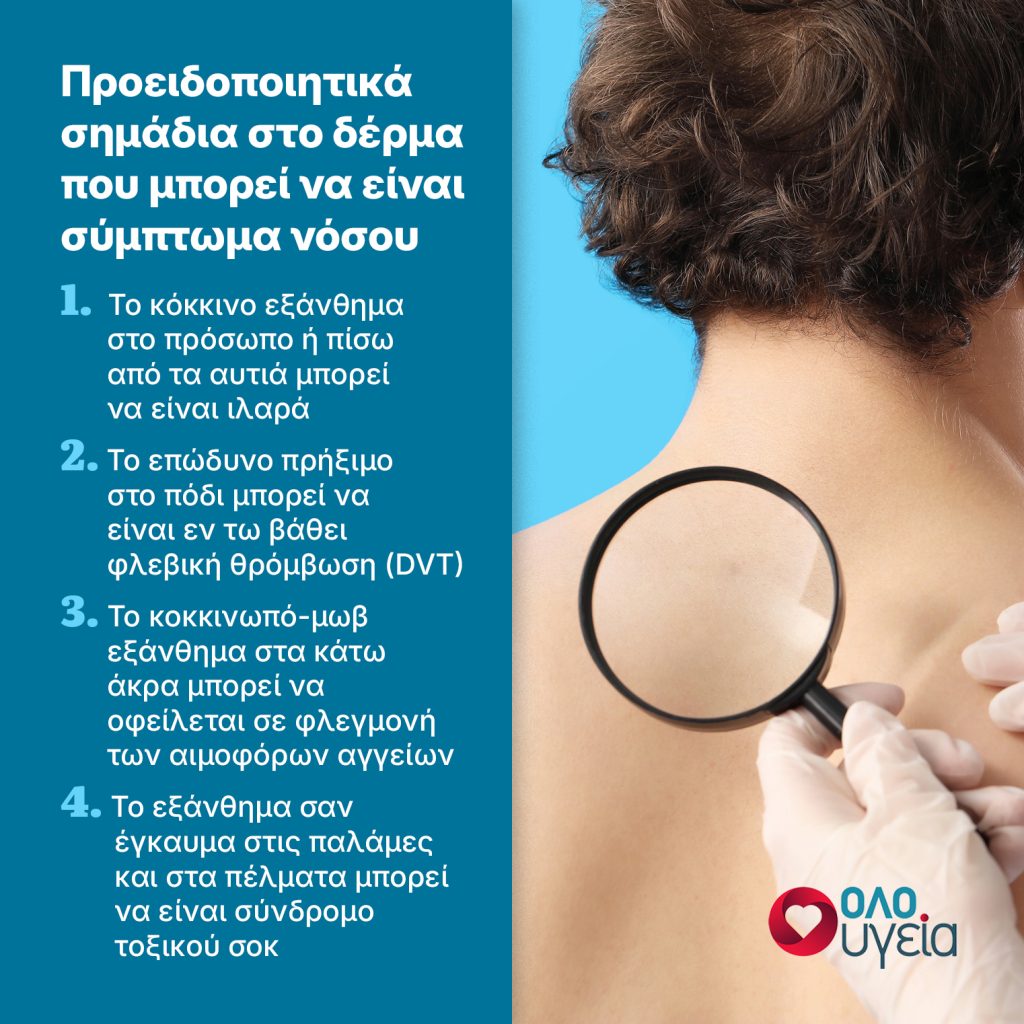 Ποια σημάδια στο δέρμα μπορεί να είναι σύμπτωμα νόσου – Τι πρέπει να ξέρετε