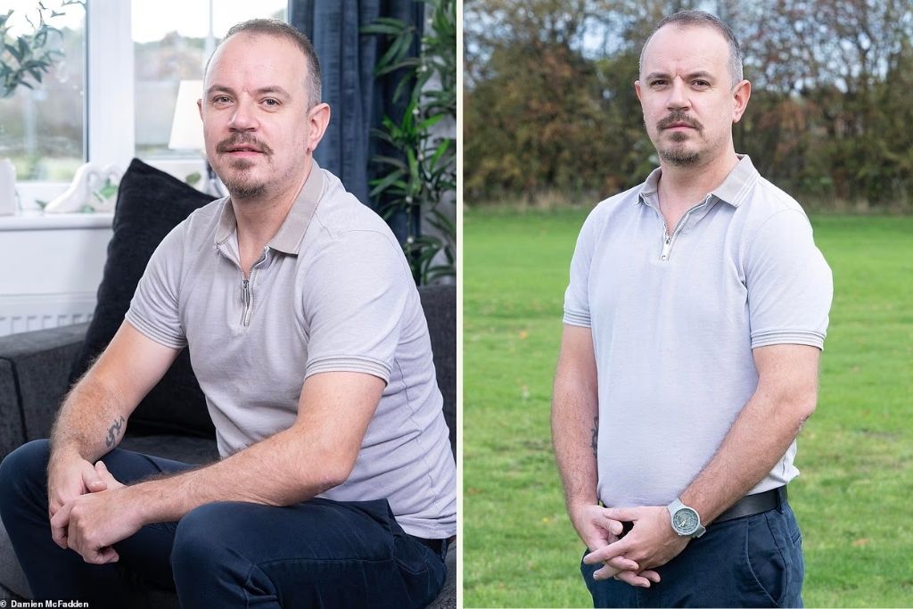 Τι έπαθε 35χρονος μετά από χτύπημα στο κεφάλι: «Έδειχνα 55 χρονών, πάχυνα και η λίμπιντό μου είχε πεθάνει»