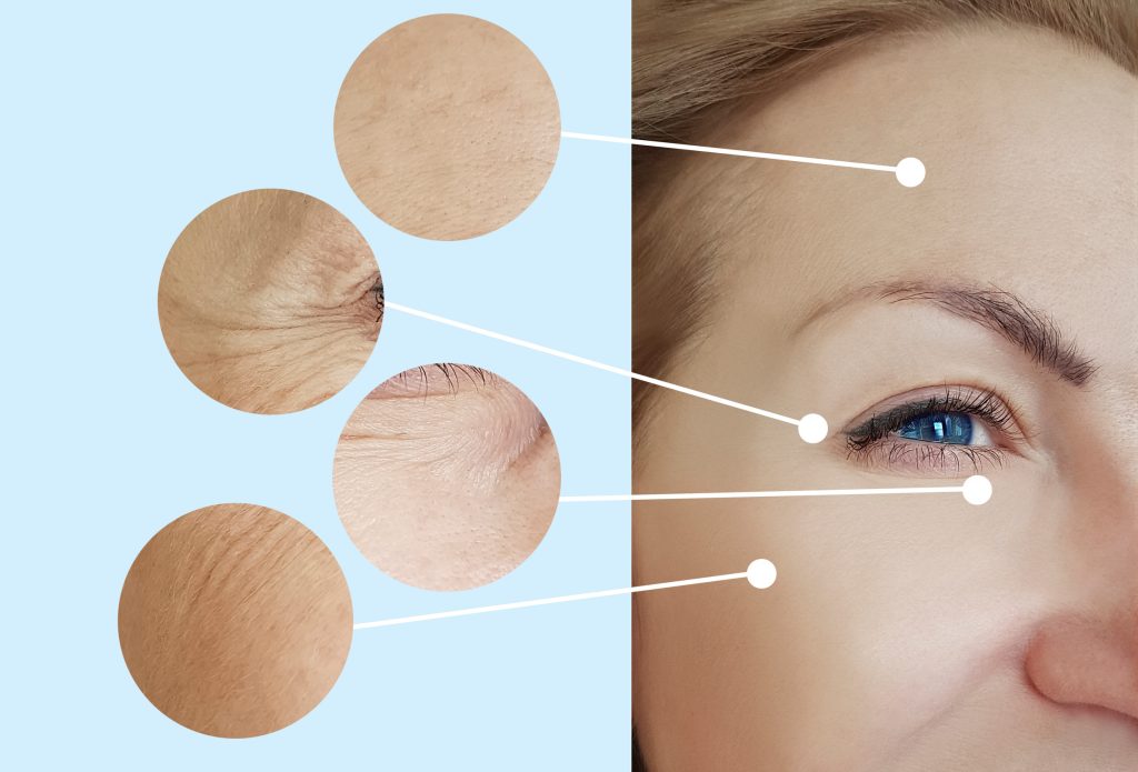 Πώς να απαλλαγείτε από τις ρυτίδες, σύμφωνα με το Cleveland – Θεραπείες στο σπίτι και το ιατρείο