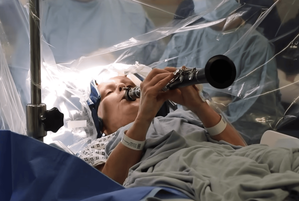 Ασθενής με Πάρκινσον παίζει κλαρινέτο κατά τη διάρκεια εγχείρησης εγκεφάλου [ΒΙΝΤΕΟ]