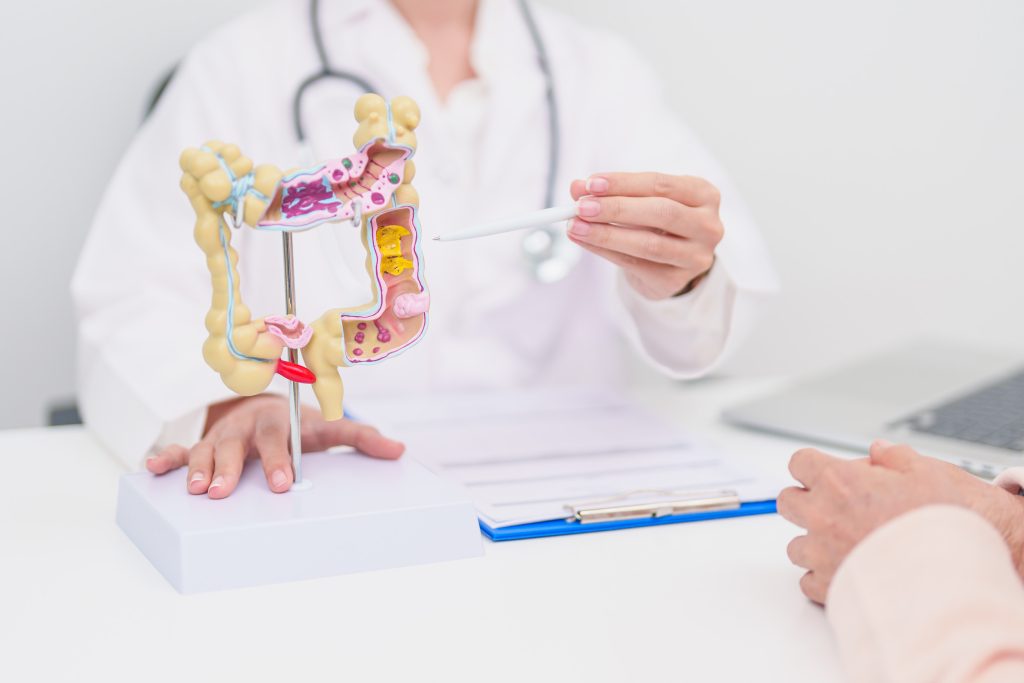 Εκκολπωμάτωση παχέος εντέρου: Ποιοι κινδυνεύουν και πώς αντιμετωπίζεται