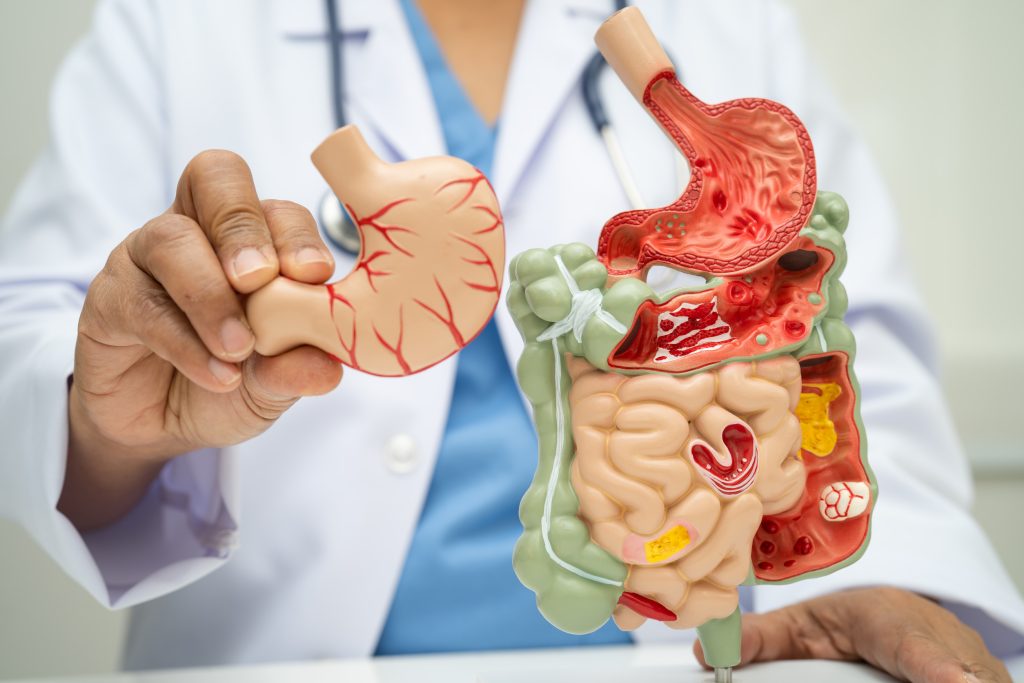 Φραγμένες αρτηρίες: Το πρόβλημα μπορεί να ξεκινάει από το έντερο – Πώς να προστατευθούμε