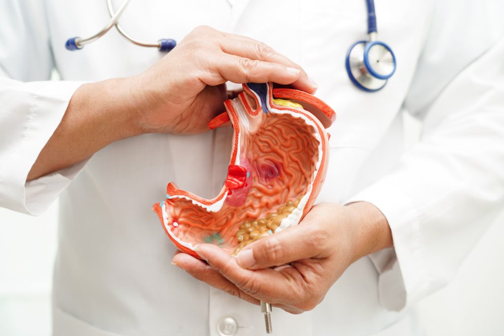 Καρκίνος του στομάχου: 5 προειδοποιητικά σημάδια που είναι δύσκολο να αναγνωρίσουμε