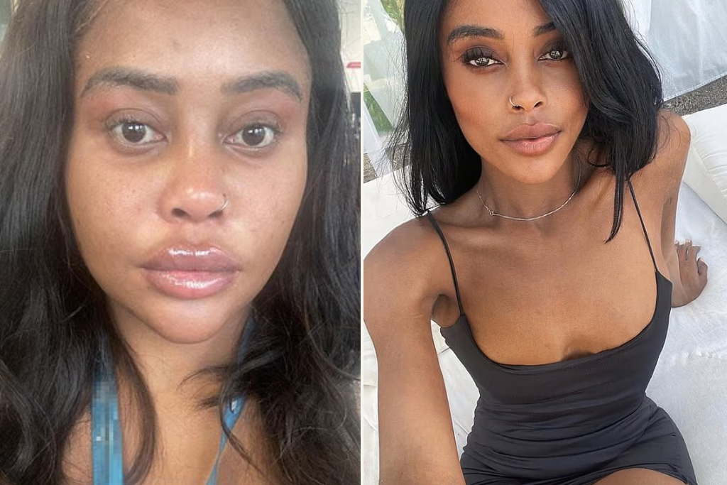 Είναι 30 και έχει ήδη ξοδέψει μια περιουσία για πλαστικές – Πώς μοιάζει σήμερα;