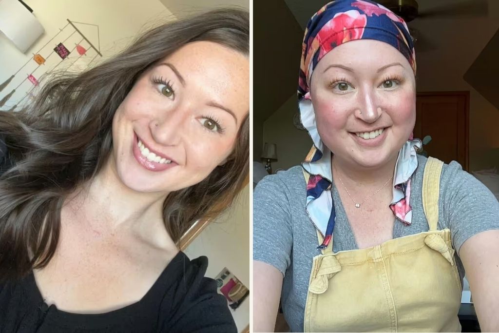 «Νόμιζα ότι ο πόνος στην πλάτη ήταν τραυματισμός από το τρέξιμο, αλλά μου διέγνωσαν καρκίνο σταδίου 4» – Συγκλονιστική μαρτυρία 30χρονης