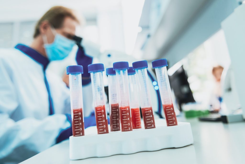 Υψηλή ASTO: Τι σημαίνει και πότε να απευθυνθείτε σε ειδικό