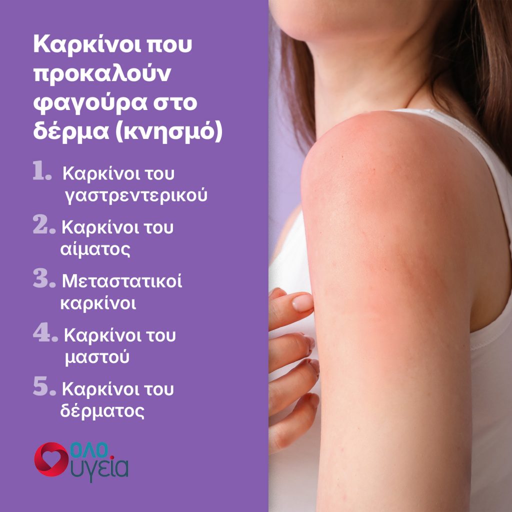 Πότε μπορεί η φαγούρα στο δέρμα να είναι σημάδι καρκίνου – Ειδικός του Cleveland απαντά