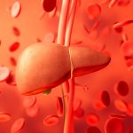 Λίπος στο συκώτι: Οι 4 χειρότερες τροφές για το λιπώδες ήπαρ, σύμφωνα με ηπατολόγο