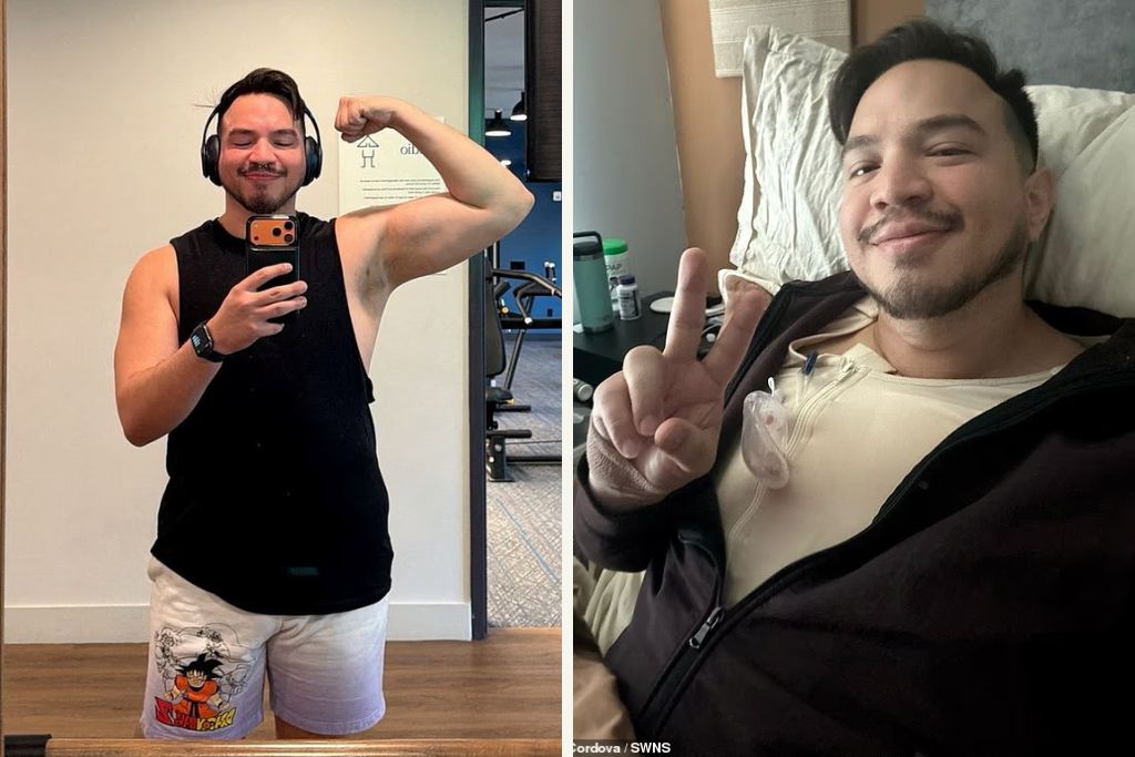 32χρονος ξόδεψε μια περιουσία για να μικρύνει το στήθος του επειδή δεχόταν συνεχώς αρνητικά σχόλια: «Νιώθω πιο άντρας τώρα»