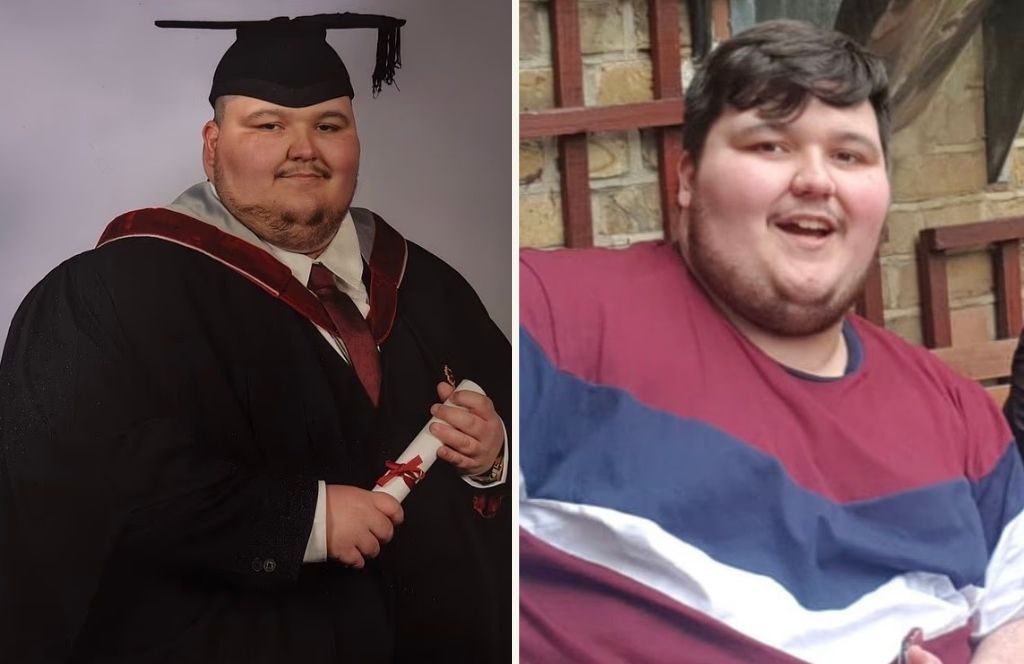 24χρονος που «έτρωγε μέχρι θανάτου» έχασε 116 κιλά χωρίς ενέσεις – Η απλή άσκηση που όπως ισχυρίζεται άλλαξε τη ζωή του