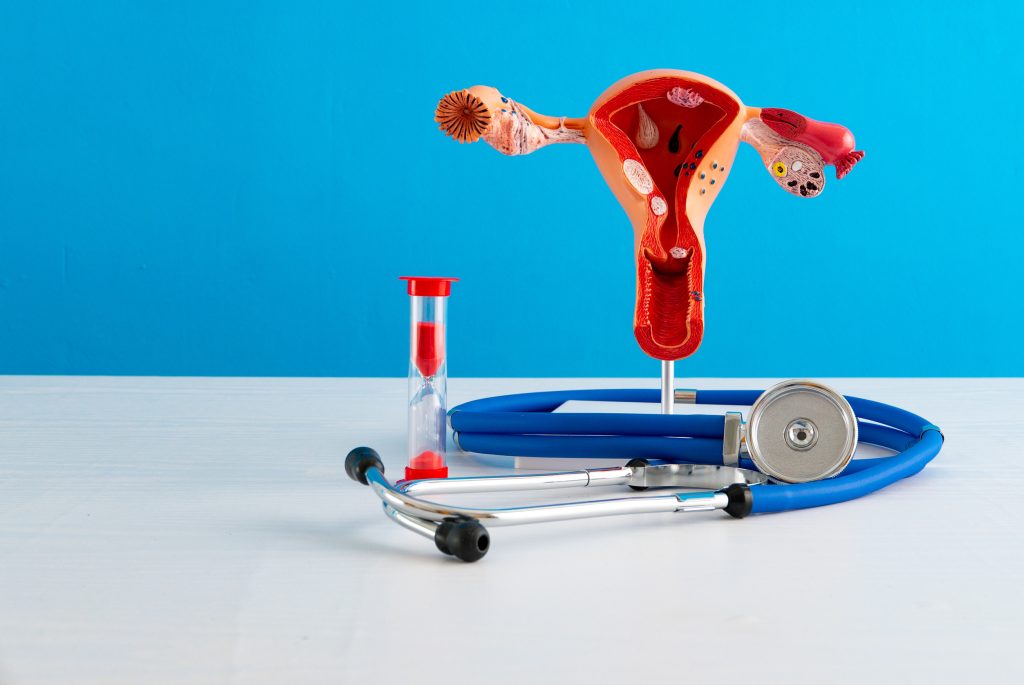 Καρκίνος του ενδομητρίου: Ποια τα πρώιμα συμπτώματα – Τι αυξάνει τον κίνδυνο