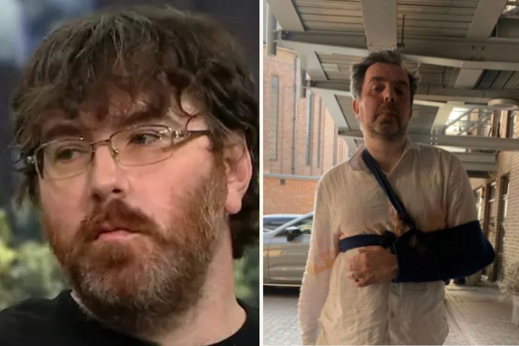 Δύο άνδρες με το μικρότερο και το μεγαλύτερο πέος στον κόσμο μιλούν για τις δυσκολίες που αντιμετωπίζουν: «Είναι κατάρα»