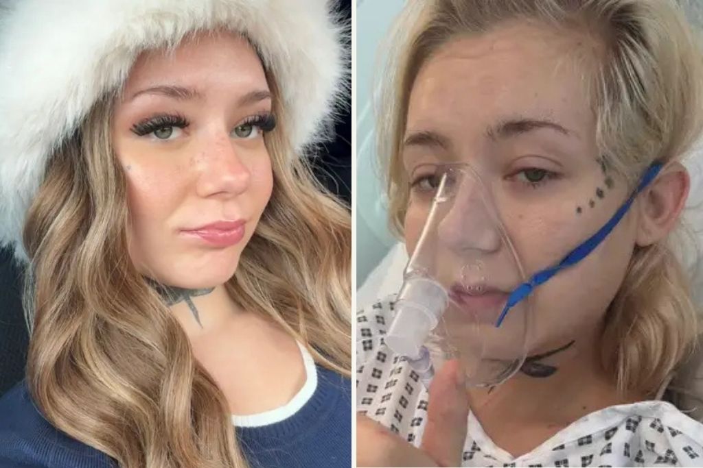 Ξεκίνησε το vaping στα 15 της και τώρα της δίνουν 18 μήνες ζωής: «Οι γιατροί είπαν ότι έχω πνευμόνια 80χρονου»