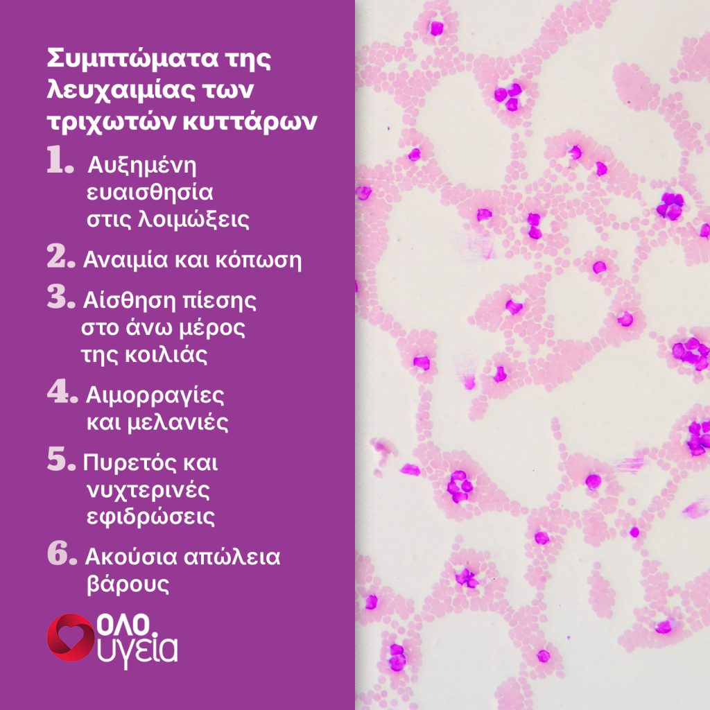 Νιώθετε εξάντληση και αρρωσταίνετε συχνά; Πότε μπορεί να είναι συμπτώματα λευχαιμίας